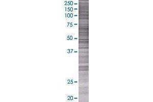 TMEM175 transfected lysate. (MGC4618 293T Cell Transient Overexpression Lysate(Denatured))