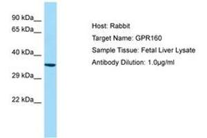 Image no. 1 for anti-G Protein-Coupled Receptor 160 (GPR160) (AA 40-89) antibody (ABIN6750006) (GPR160 antibody  (AA 40-89))