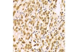 Immunohistochemistry (Paraffin-embedded Sections) (IHC (p)) image for anti-Lamin A/C (LMNA) (AA 403-572) antibody (ABIN3020785)