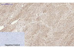 Immunohistochemical analysis of paraffin-embedded human uterus tissue. (RANKL antibody  (C-Term))