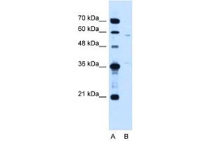 MGC39633 antibody used at 1. (MGC39633 (N-Term) antibody)