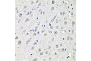 Immunohistochemistry of paraffin-embedded mouse brain using CHCHD3 antibody. (CHCHD3 antibody  (AA 1-227))