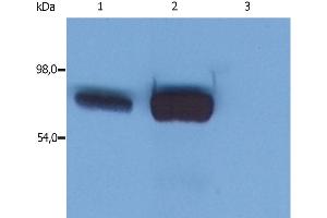 Western Blotting analysis (reducing conditions) of whole cell lysate using anti-SLP76 (SLP-76/03). (LCP2 antibody  (AA 216-434))