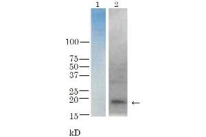 Western Blotting (WB) image for anti-TRH Toxin antibody (ABIN2452158)