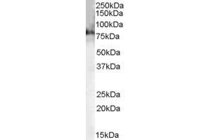 Western Blotting (WB) image for anti-Choline O-Acetyltransferase (CHAT) (AA 629-642) antibody (ABIN299161) (Choline Acetyltransferase antibody  (AA 629-642))