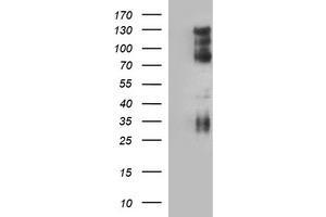 Image no. 1 for anti-CD44 (CD44) antibody (ABIN1497321) (CD44 antibody)