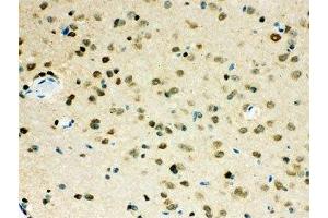 IHC-P testing of VCP antibody and mouse brain tissue (VCP antibody  (AA 732-760))
