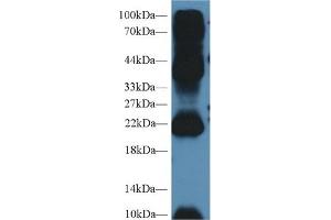 Western Blot; Sample: Mouse Testis lysate; Primary Ab: 2µg/ml Rabbit Anti-Human AGR2 Antibody Second Ab: 0. (AGR2 antibody  (AA 21-175))