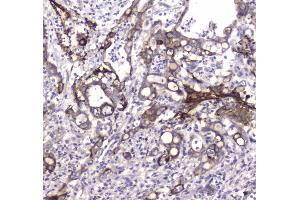 IHC analysis of MAP1LC3A using anti-MAP1LC3A antibody . (MAP1LC3A antibody  (AA 1-120))