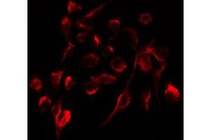 ABIN6267299 staining HepG2 by IF/ICC. (Integrin beta 3 antibody  (pTyr773))