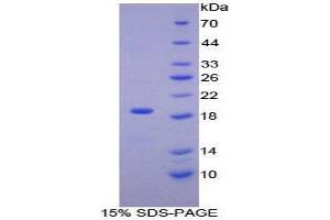 SDS-PAGE (SDS) image for Heme Oxygenase (Decycling) 1 (HMOX1) (AA 145-237) protein (His tag,SUMO Tag) (ABIN1170606) (HMOX1 Protein (AA 145-237) (His tag,SUMO Tag))