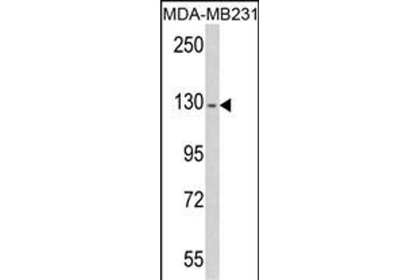 RASGRF1 antibody  (AA 907-936)