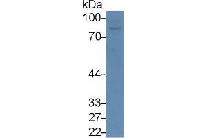 Detection of CD26 in Mouse Spleen lysate using Polyclonal Antibody to Cluster Of Differentiation 26 (CD26) (DPP4 antibody  (AA 631-760))