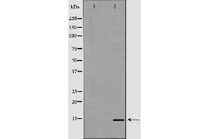 Western blot analysis of extracts of mouse liver, using PPBP antibody. (CXCL7 antibody  (Internal Region))