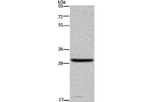 Western blot analysis of A375 cell, using DHRS3 Polyclonal Antibody at dilution of 1:600 (DHRS3 antibody)