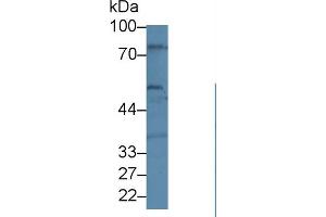 Western blot analysis of Human U87-MG cell lysate, using Human BEST1 Antibody (1 µg/ml) and HRP-conjugated Goat Anti-Rabbit antibody ( (Bestrophin 1 antibody  (AA 292-585))