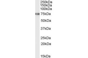 Western Blotting (WB) image for anti-Fem-1 Homolog C (FEM1C) (C-Term) antibody (ABIN2465691) (FEM1C antibody  (C-Term))