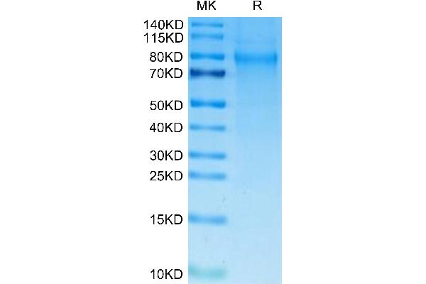 TIMD4 Protein (AA 25-314) (His tag)