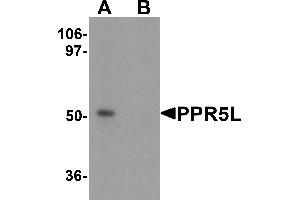 Western blot analysis of PRR5L in 3T3 cell lysate with PRR5L antibody at 1 µg/mL in (A) the absence and (B) the presence of blocking peptide (PRR5L antibody  (Middle Region))