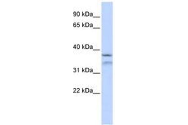 HYLS1 antibody  (AA 216-265)