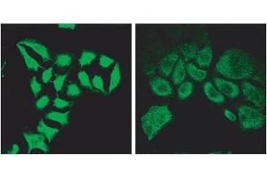 AP32083PU-N Spartin Antibody (2 µg/ml) staining of methanol-fixed HeLa before (left) and after (right) introduction of siRNA. (SPG20 antibody  (Internal Region))