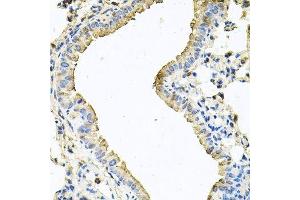 Immunohistochemistry of paraffin-embedded mouse lung using CHCHD3 antibody. (CHCHD3 antibody  (AA 1-227))