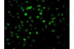 Immunofluorescence (IF) image for anti-Poly (ADP-Ribose) Polymerase 1 (PARP1) antibody (ABIN7127667)