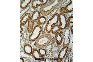 Immunohistochemistry (IHC) image for anti-NADH Dehydrogenase (Ubiquinone) 1, Subcomplex Unknown, 2, 14.5kDa (NDUFC2) antibody (ABIN2995814) (NDUFC2 antibody)