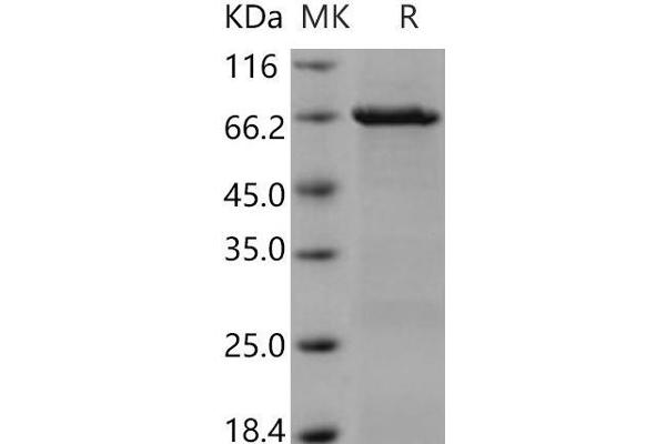 CSK Protein (GST tag)