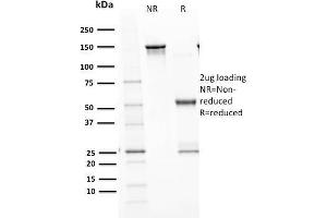 SDS-PAGE (SDS) image for anti-Tumor Protein P53 (TP53) antibody (ABIN6940791)