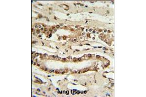 FOXP1 Antibody IHC analysis in formalin fixed and paraffin embedded lung tissue followed by peroxidase conjugation of the secondary antibody and DAB staining. (FOXP1 antibody  (C-Term))