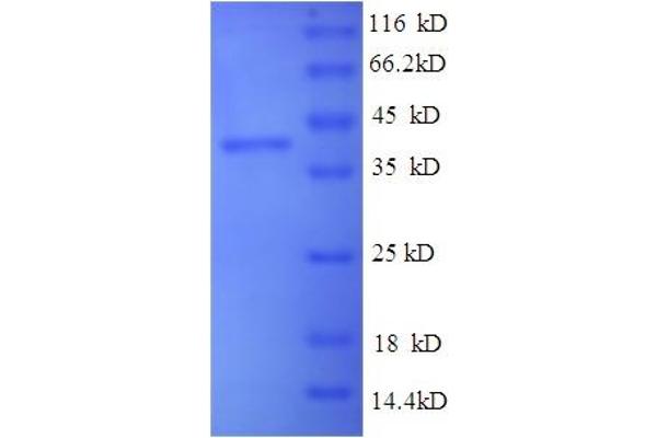 Selenoprotein P Protein (SEPP1) (AA 20-381) (His tag)