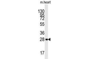 Western Blotting (WB) image for anti-Protein Kinase, AMP-Activated, beta 1 Non-Catalytic Subunit (PRKAB1) antibody (ABIN3002958) (PRKAB1 antibody)