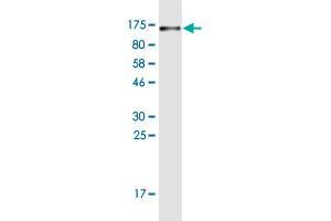 Western Blot detection against Immunogen (102. (CD44 antibody  (AA 1-699))