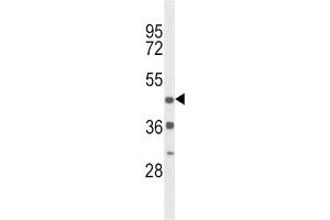 Western Blotting (WB) image for anti-Dopamine Receptor D4 (DRD4) antibody (ABIN3003899) (DRD4 antibody)