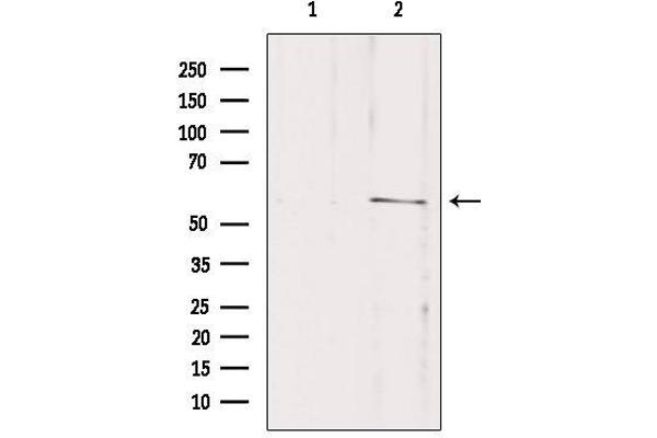 SLC16A2/MCT8 antibody  (Internal Region)