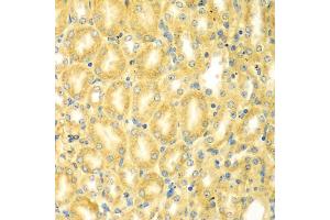 Immunohistochemistry of paraffin-embedded mouse kidney using PDE4DIP antibody (ABIN5975638) at dilution of 1/100 (40x lens). (PDE4DIP antibody)