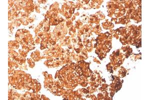 Formalin-fixed, paraffin-embedded human pancreas stained with KRT6A Recombinant Mouse Monoclonal Antibody (rKRT6A/2100). (Recombinant KRT6A antibody)