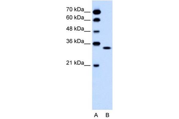 OR5T2 antibody  (C-Term)