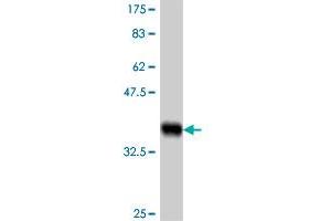 Western Blot detection against Immunogen (37. (LOXL3 antibody  (AA 171-270))