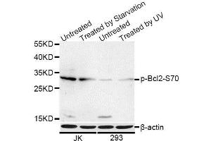 Western blot analysis of extracts of Jurkat and 293 cells, using Phospho-Bcl2 -S70 antibody. (Bcl-2 antibody  (pSer70))