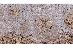 Human tonsil: immunohistochemical staining for Immunoglobulin G. (IgG antibody)