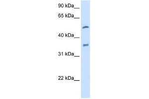 WB Suggested Anti-CYP2D6 Antibody Titration:  2. (CYP2D6 antibody  (N-Term))