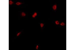 ABIN6266885 staining HT29 by IF/ICC. (EGR1 + EGR2 antibody)