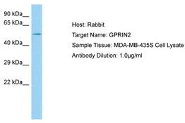 GPRIN2 antibody  (AA 21-70)