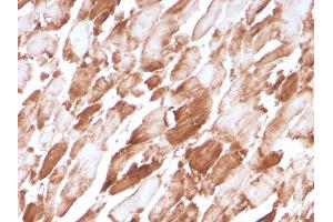 Formalin-fixed, paraffin-embedded human Cardiac Muscle stained with Sarcomeric Actinin Alpha 2 Mouse Monoclonal Antibody (ACTN2/3294). (ACTN2 antibody  (AA 557-692))