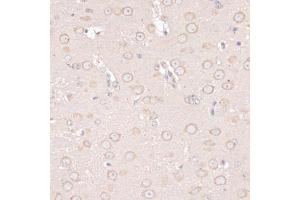 Immunohistochemistry of paraffin-embedded mouse brain using ABCF2 antibody. (ABCF2 antibody)