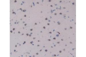 Used in DAB staining on fromalin fixed paraffin- embedded Kidney tissue (IL17RA antibody  (AA 617-847))