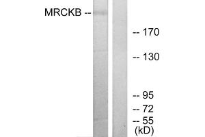 Western blot analysis of extracts from COLO cells, using MRCKB antibody. (CDC42BPB antibody  (C-Term))