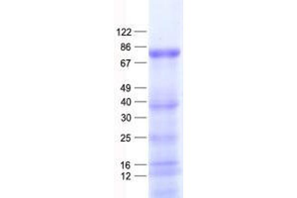 ZNF175 Protein (His tag)